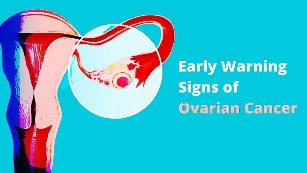 Early Warning Signs of Ovarian Cancer Every Woman Should Know